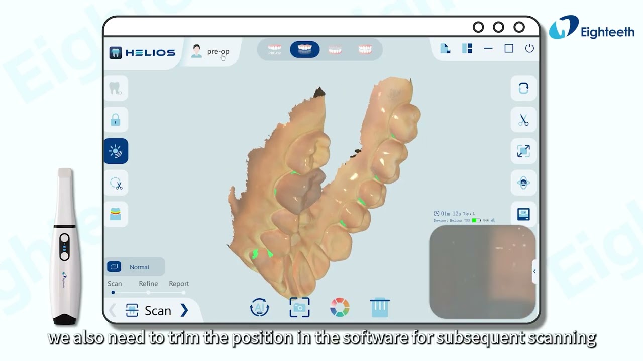 𝐇𝐞𝐥𝐢𝐨𝐬 𝐒𝐞𝐫𝐢𝐞𝐬 | 𝐏𝐫𝐞-𝐎𝐩𝐞𝐫𝐚𝐭𝐢𝐨𝐧 𝐒𝐜𝐚𝐧 𝐖𝐨𝐫𝐤𝐟𝐥𝐨𝐰