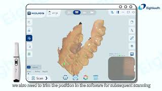 𝐇𝐞𝐥𝐢𝐨𝐬 𝐒𝐞𝐫𝐢𝐞𝐬 𝐏𝐫𝐞-𝐎𝐩𝐞𝐫𝐚𝐭𝐢𝐨𝐧 𝐒𝐜𝐚𝐧 𝐖𝐨𝐫𝐤𝐟𝐥𝐨𝐰