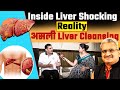 Liver Damage? Cleansing Therapy से हुआ चमत्कार! | Dr. Piyush Saxena | National Health