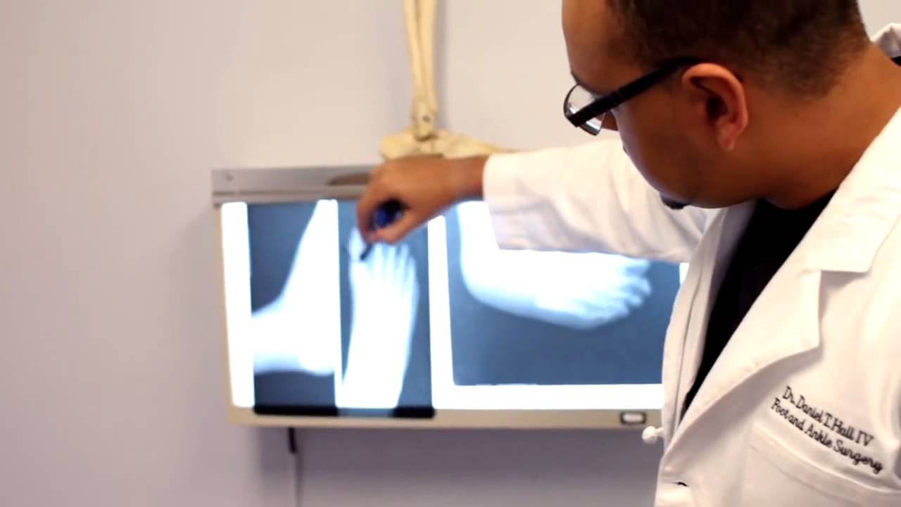 Louisiana Foot and Ankle Specialists YouTube