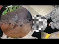 😱🦶 Jigger Gigante Extraído – Limpeza Completa dos Pés! #BV016