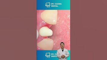 Đây là cái gì vậy??? |Dr Cường Official