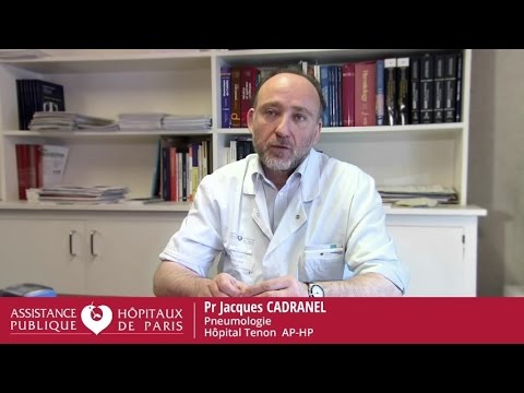 Itw du Pr Jacques Cadranel: Cancer du poumon & VIH - Etude CHIVA Itw du Pr Jacques Cadranel: Cancer du poumon & VIH - Etude CHIVA