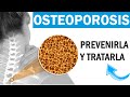 OSTEOPOROSIS: Cómo Prevenirla y Tratarla desde la Medicina Integrativa ✅ (Dr. Tinao)