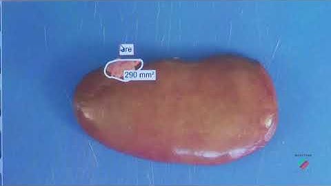 MacroPATH Digital Imaging Solution
