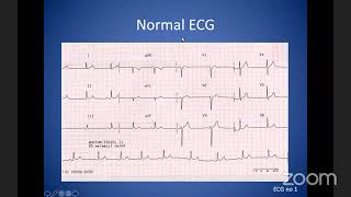 Gpep Uk 4Th Ecg Workshop
