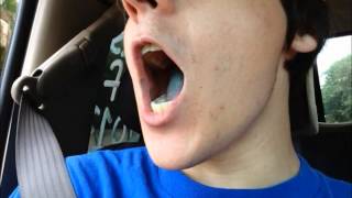 (Rage Day 23) Hangnails