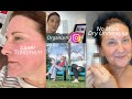 No more dry under eyes  how i organize instagram  moxi laser  a vlog