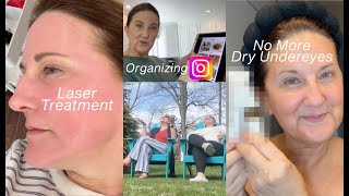 No More Dry Under Eyes // How I Organize Instagram // Moxi Laser // A Vlog