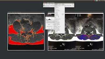 用imagej的ROI manager選取不同顏色的組織(1)