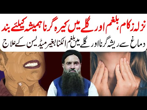 Nazla Zukam Ka Ilaj Flu Treatment Gale Mein Resha Girna Dr Sharafat Ali