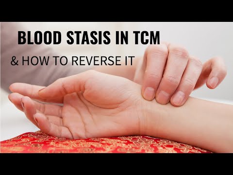 Blood Stasis In TCM And How To Reverse It 