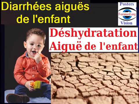 Deshydratation Aigue Du Nourrisson Secondaire A Une Diarrhee Signes Cliniques Et Explorations Youtube