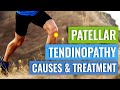 Petellar Tendinopathy Treatment - including exercises