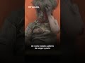 Omran Daquesh, el niño sirio, antes y después