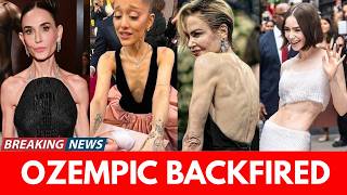 16 Celebs Suffering From Ozempic Face | Before & After 2026