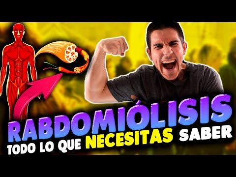 Video: 3 formas sencillas de tratar la rabdomiólisis