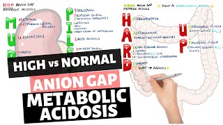 High vs Normal Anion Gap Metabolic Acidosis - Mnemonic (MUDPILES & HARD UP)