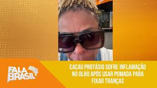 Cacau Protásio sofre inflamação no olho após usar pomada para fixar tranças | 'Fala Brasil'