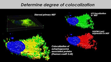 The Complete Image Analysis Suite for Life Scientists
