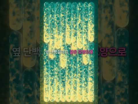 잘못 접힌 단백질 하나가 뇌를 무너뜨린다