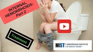 HEMORRHOIDS Part 2: Treatments, procedures, surgery to help hemorrhoids