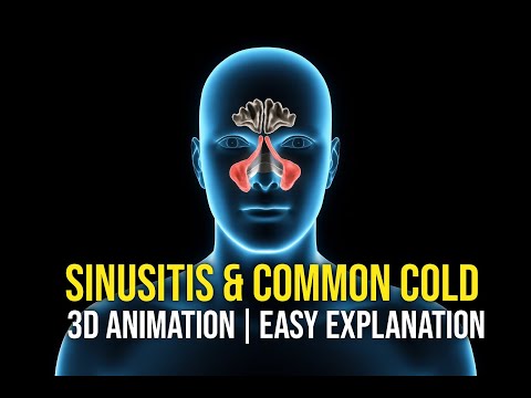 Sinusitis & Common Cold | 3D Animation | Easy Explanation