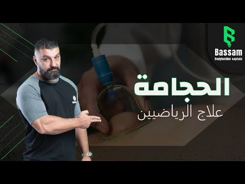 هل الحجامة علاج للرياضيين