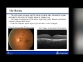 Optical Coherence Tomography Imaging Analysis for Retinal Disease