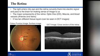 Optical Coherence Tomography Imaging Analysis for Retinal Disease