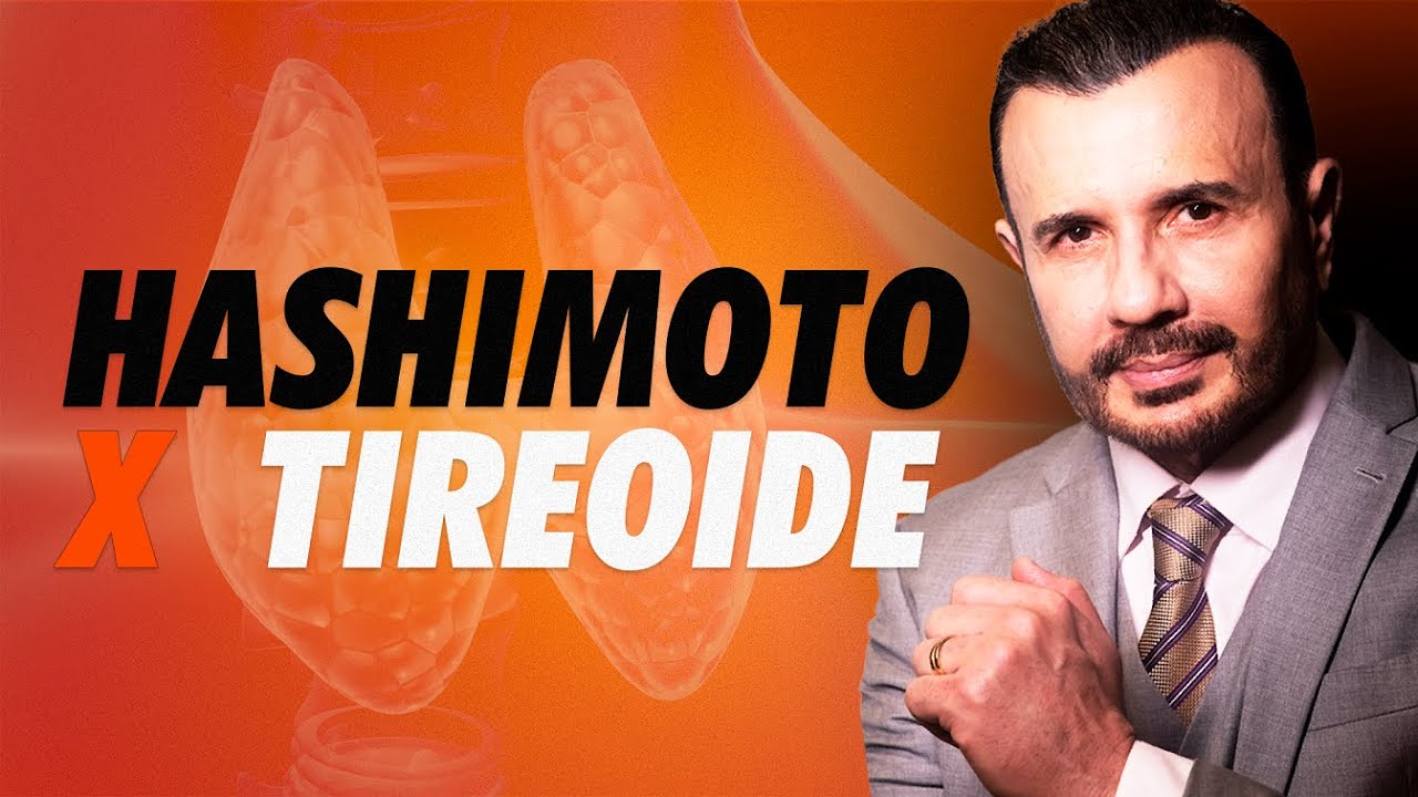 Vozes Que Informam - Hashimoto: Muito além da tireoide. | Dr Italo Rachid