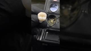 Dental motivation. Dental technic. Modeling anatomy teeth. Dentistry #dental #dentistry #veneers