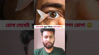 চোখ দেখেই বুঝুন শরীরের গোপন রোগ! 😳 (শেষটা মিস করবেন না) #eyehealth #healthtips #youtubeshorts