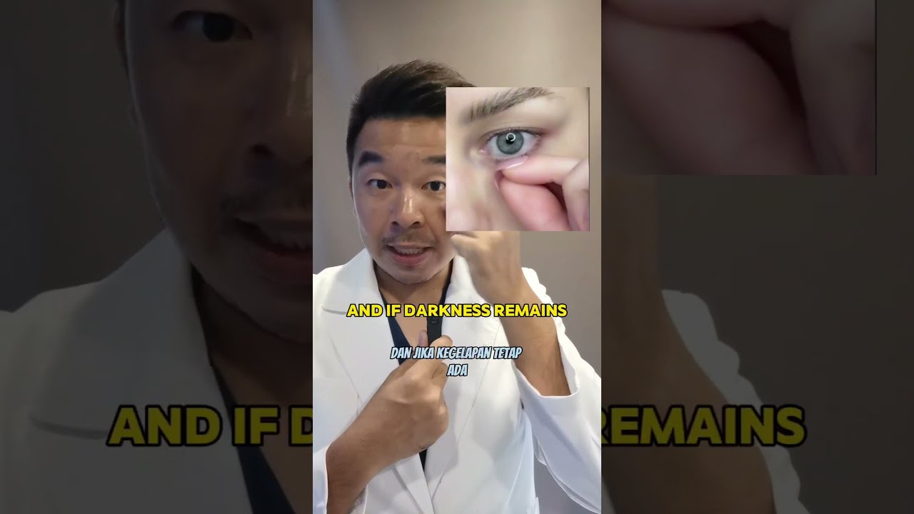 Dark Circles Under Your Eyes 
