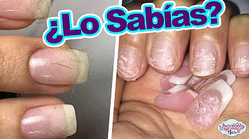¿Cuánto tiempo se pueden dejar las uñas prensadas?