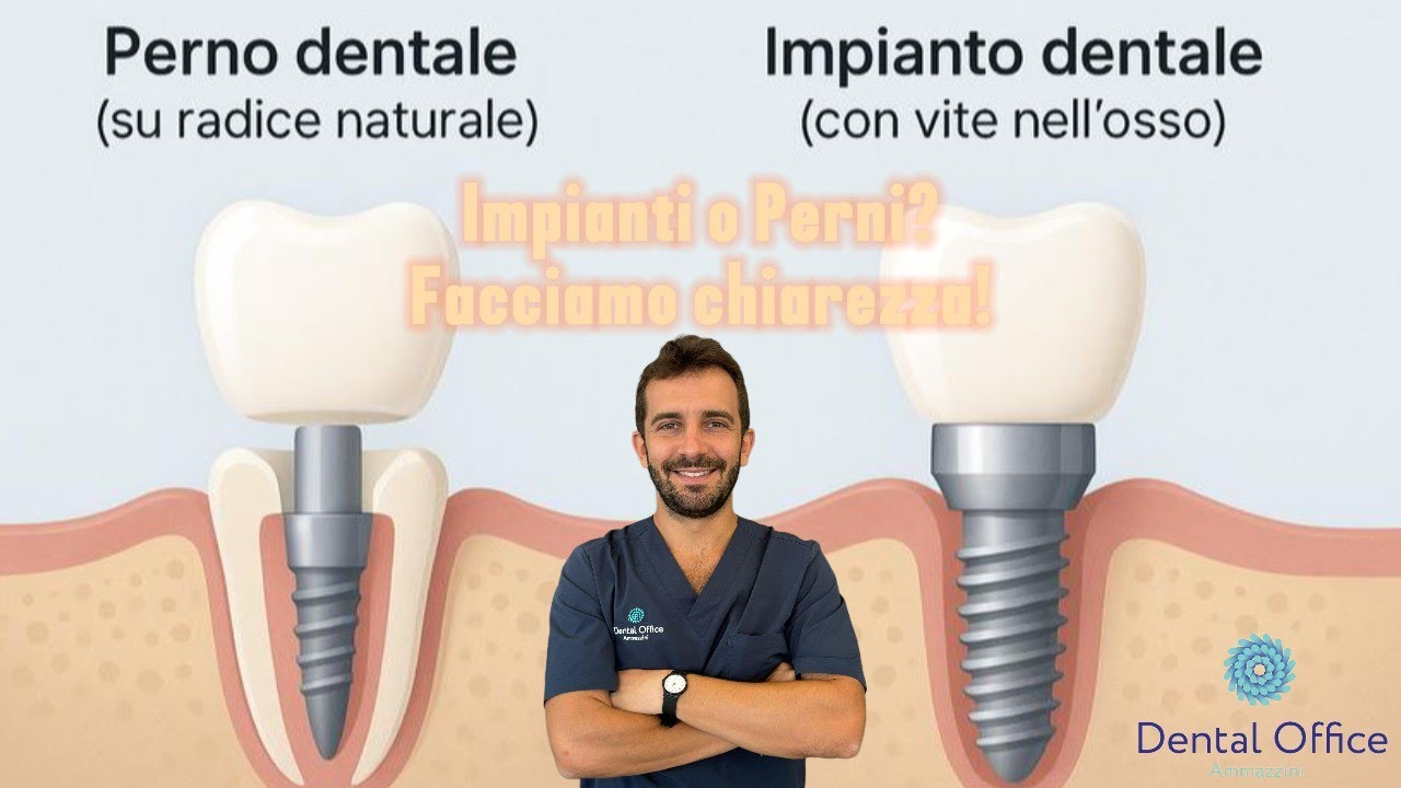 PERNO e IMPIANTO: non sono la stessa cosa!