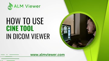 How to Use Cine Tool in Dicom Viewer - By Alm Viewer
