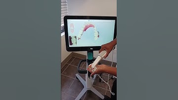 See your future smile come to life with our iTero Scanner!
