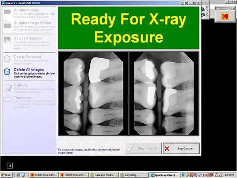 QuickRay Compatibility: Carestream (Kodak)