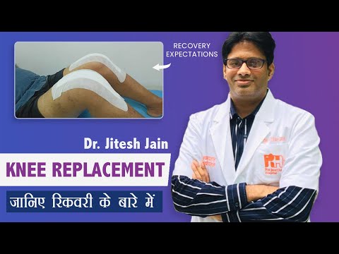 Recovery expectation after Total Knee Replacement Surgery by Dr. Jitesh Jain, Jaipur (In Hindi)