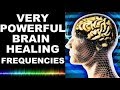 Brain healing sounds  healed millions already  bivash vlogs presents