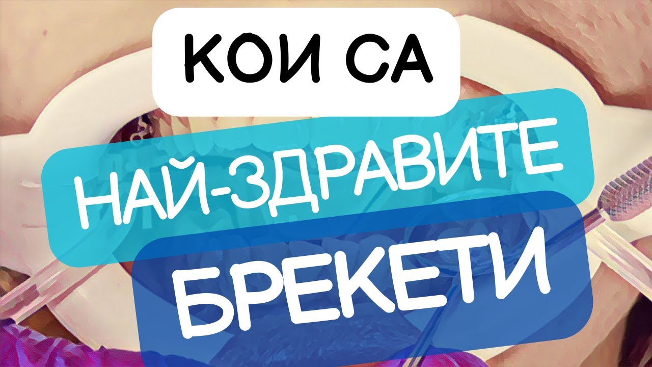 Поставяне на Брекети [Най-Здравите Брекети]