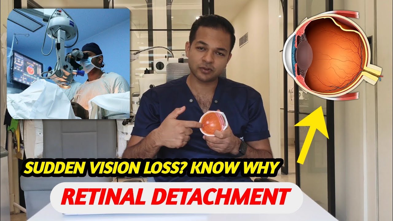 Sudden Vision Loss: Retinal Detachment Explained
