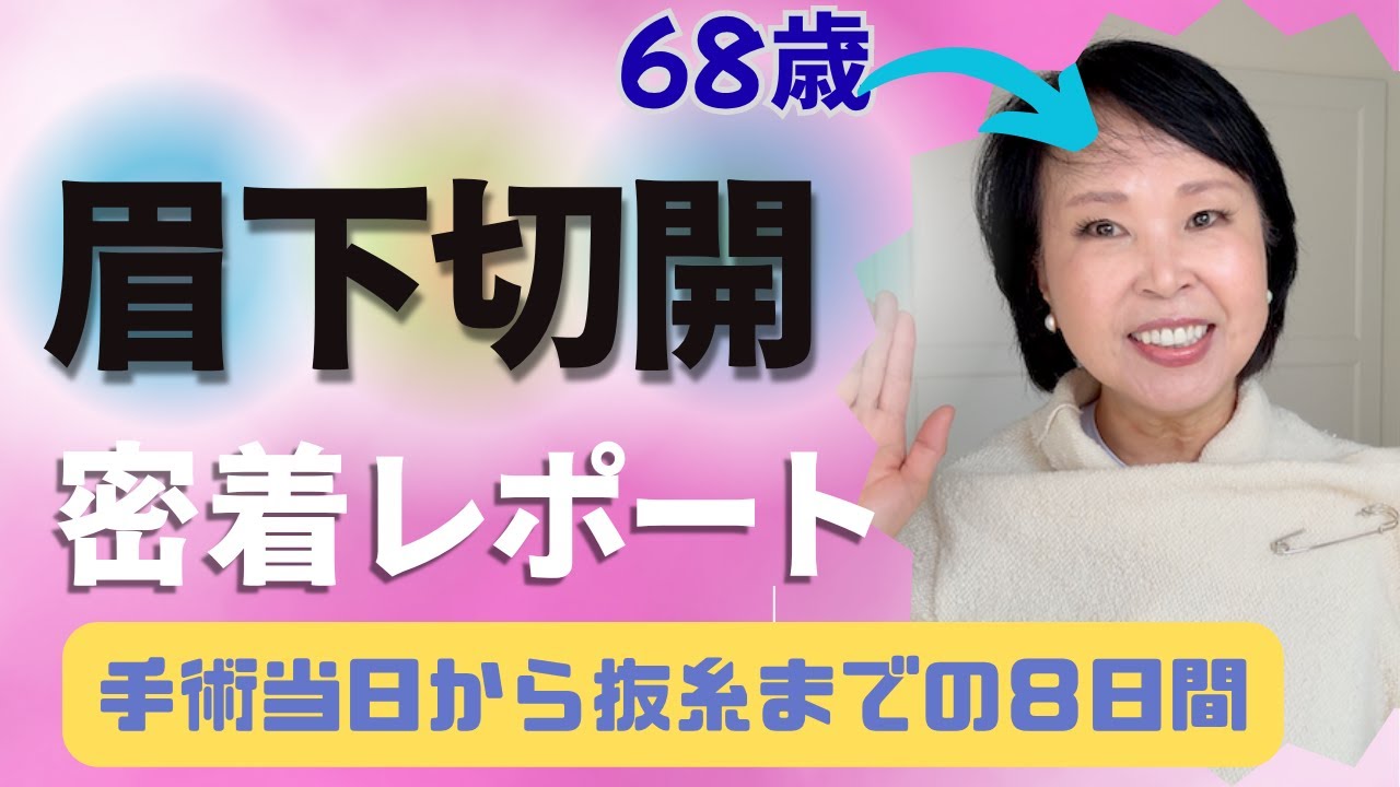 眉下切開：密着レポート、手術当日から抜糸までの８日間の完全ガイド