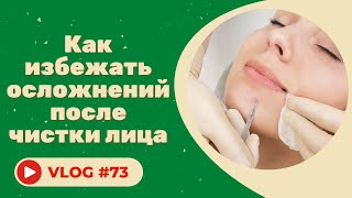 Как избежать осложнений после чистки лица / Советы косметолога