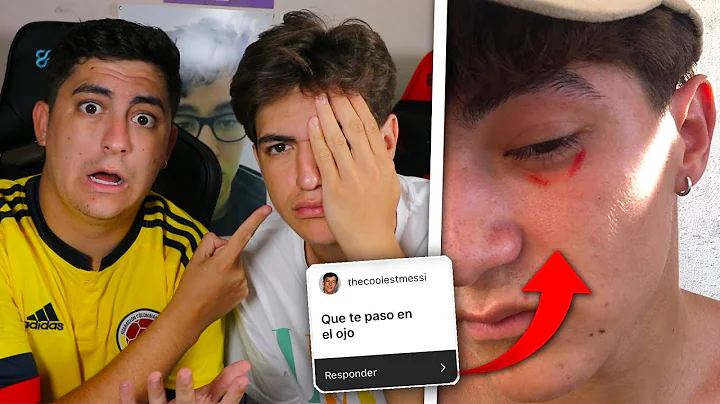 QUE LE HA PASADO A ERIC EN EL OJO?