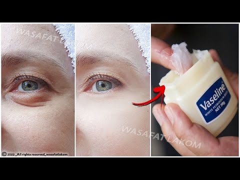 في 3 أيام قم بإزالة أكياس تحت العين تمام ا قم بإزالة الهالات السوداء والتجاعيد والانتفاخات ت