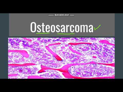 Videó: A Gyógyszerrel Töltött Kalcium-foszfát Nanokompozitok Rákellenes Hatása Az Emberi Osteosarcoma Ellen