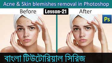 Healing Brush tool and Spot Healing Brush tool in Photoshop in Bangla (Lesson 21)