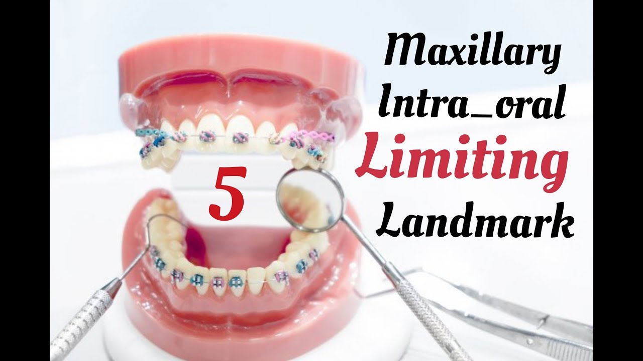 Prosthodontic_complete denture_lecture 2_maxillary limiting landmark 2 التركيبات المتحركة_المحاضرة